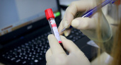 Эксперты определили самую «глупую» группу крови